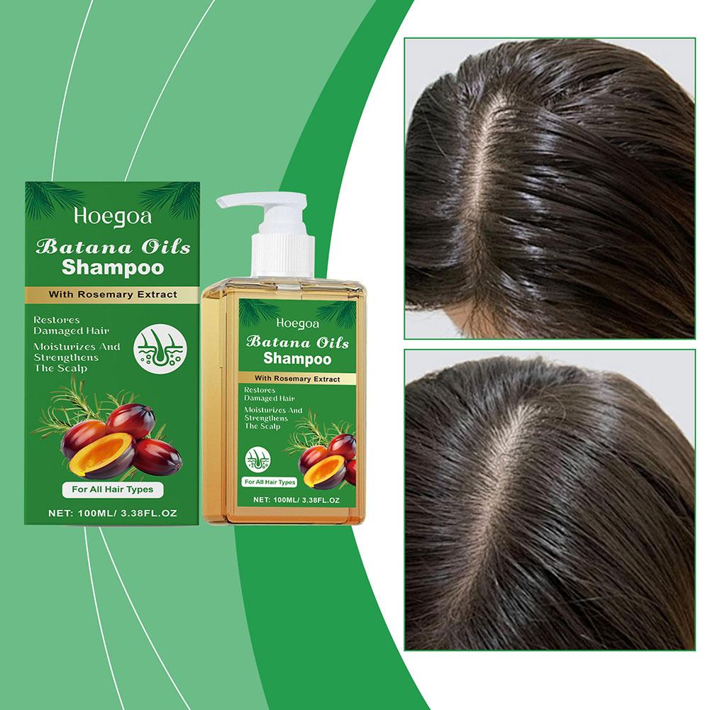 شامبو زيت البتانا وإكليل الجبل - مراجعة Rosemary Hair Oil وسعره